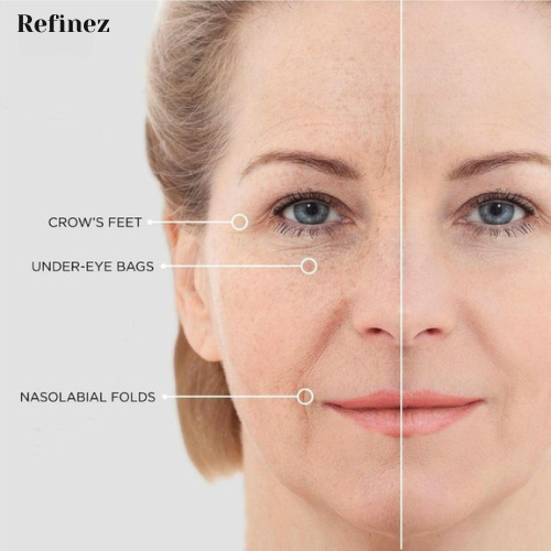 Refinez Eye Glow Mask